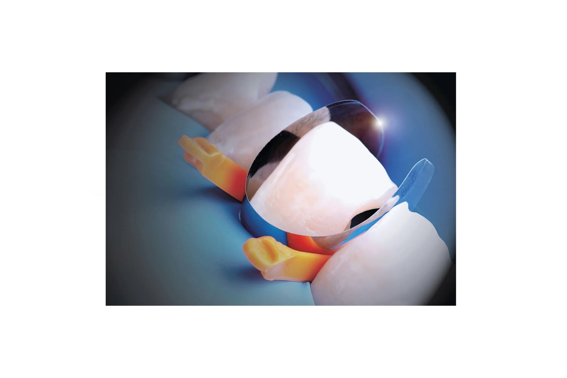 Anterior Unica proximal matricer, pakning med 12 stk
