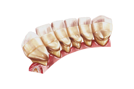 Comcord kompositbånd med fiberforstærkning, pakning med 6 cm