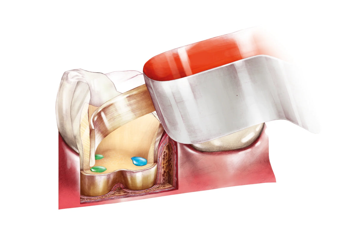 Comcord kompositbånd med fiberforstærkning, pakning med 6 cm