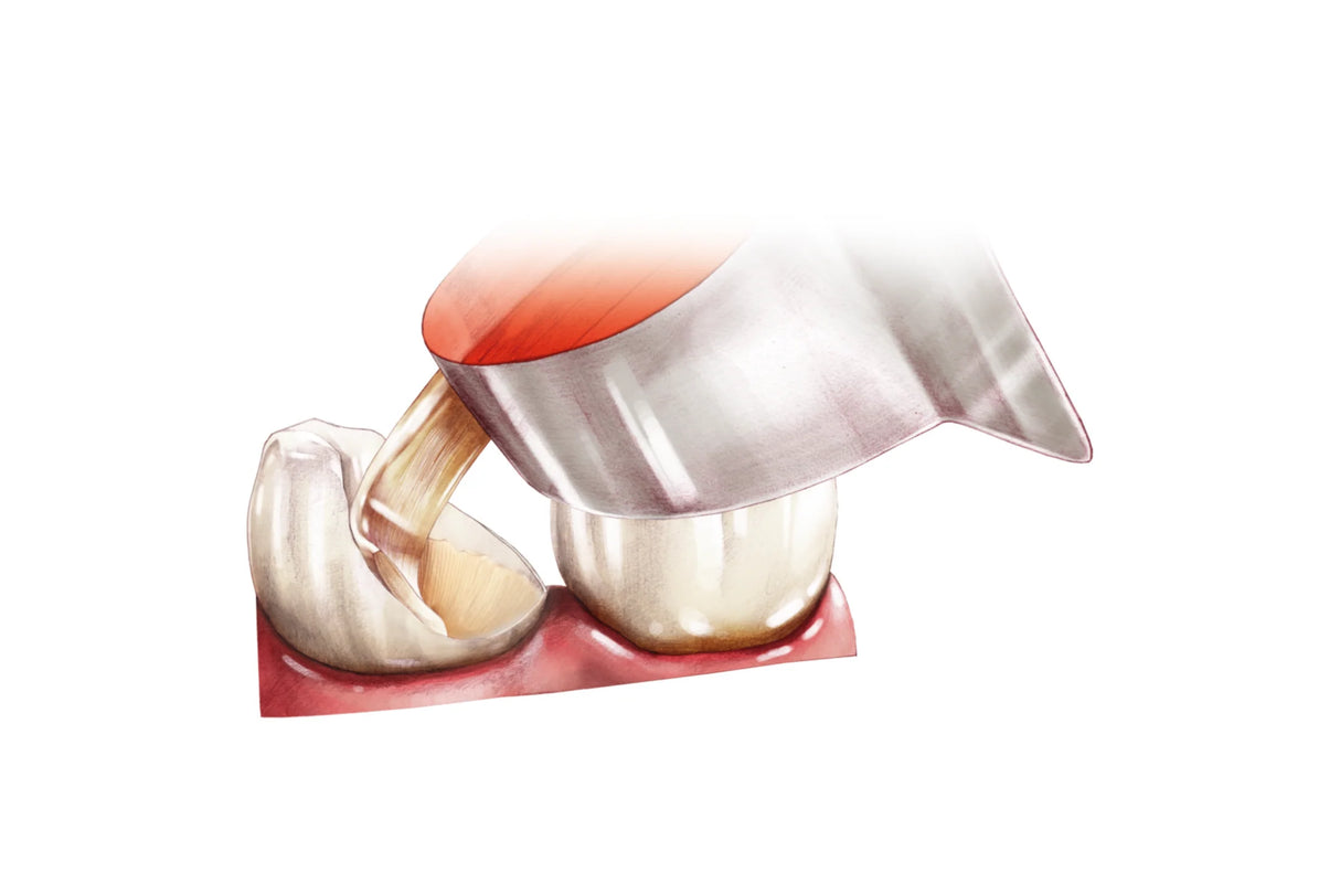 Comcord kompositbånd med fiberforstærkning, pakning med 6 cm